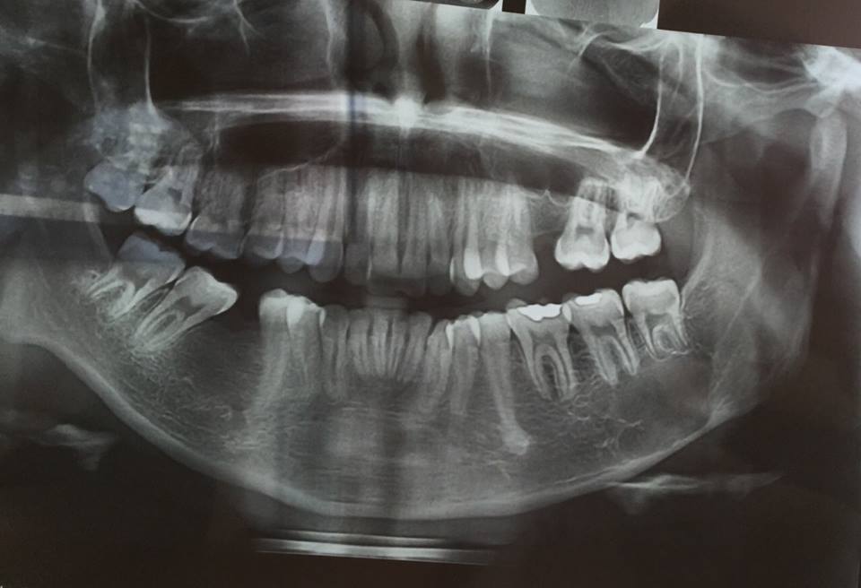 Ortodontia x Estomatologia